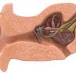 Alternatives for Middle Ear Tubes Alternatives for Middle Ear Tubes