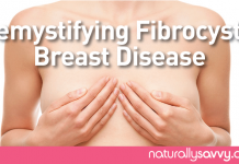 Demystifying Fibrocystic Breast Disease Demystifying Fibrocystic Breast Disease