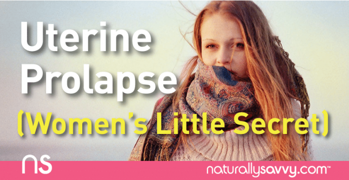 Uterine Prolapse: Women’s “Little” Secret 