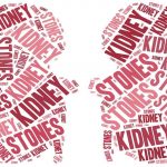 How to Prevent and Treat Kidney Stones Kidney stones