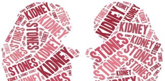 Kidney stones