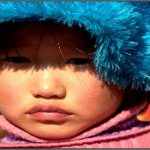 Why do U.S. Born Kids Have More Allergies than Immigrants? Why do U.S. Born Kids Have More Allergies than Immigrants?