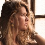 Female Hair Loss: Causes and Treatment Female Hair Loss: Causes and Treatment