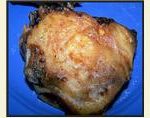 Rice Flour Chicken (Crisp and Crunchy Batter) Rice Flour Chicken (Crisp and Crunchy Batter)
