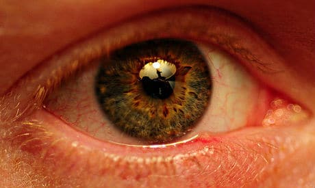 stories-diabetes_eye2 The Importance Of Eye Care For Diabetics