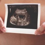 4 Prenatal Health Dangers in the Home 4 Prenatal Health Dangers in the Home