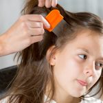 Lice: What You Need to Know Lice