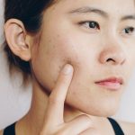 Nine Horror Foods For Skincare Disasters Bad Skin