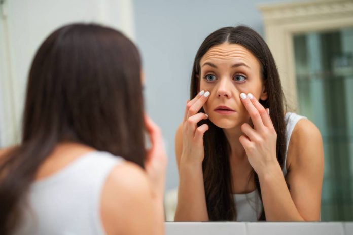 puffy bags under eyes natural remedies